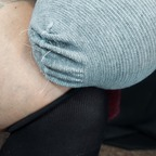 Download notoesnoleftleg OnlyFans leaks for free 

 profile picture