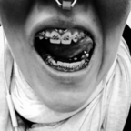 Download teethshow OnlyFans videos and photos for free 

 profile picture