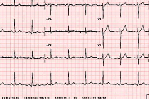 Header of u216409813